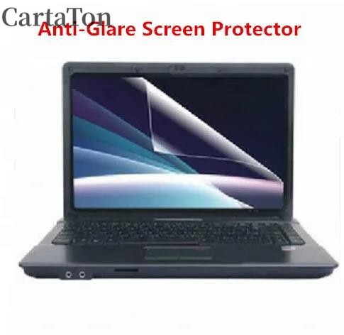 2PCS Anti-Glare reflection Mat - đánh giá và giá Laptop Accessories Must Have