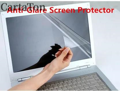 2PCS Anti-Glare reflection Mat - đánh giá và giá Laptop Accessories Must Have